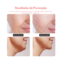 Massageador Facial Eletrico Pescoço Led Lift Fototerapia Ant